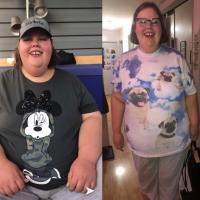 Christine Hoffman's before and after weight loss pictures side by side.